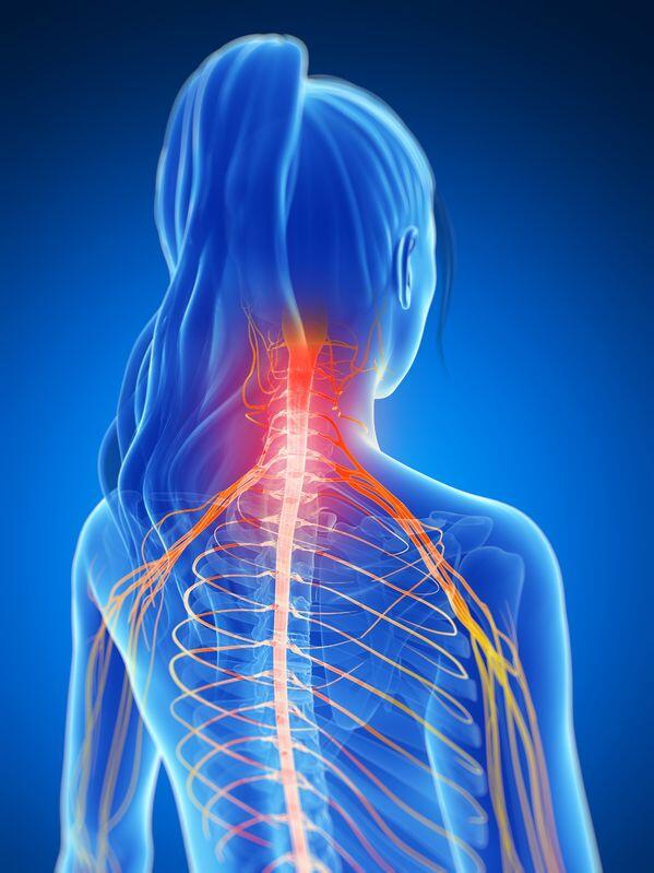 Can Neck Pain Radiate To Head